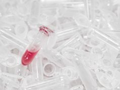 Microplastics in Human Bloodstream: A Silent Health Crisis