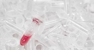 Microplastics in Human Bloodstream: A Silent Health Crisis