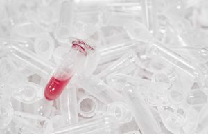 Microplastics in Human Bloodstream: A Silent Health Crisis